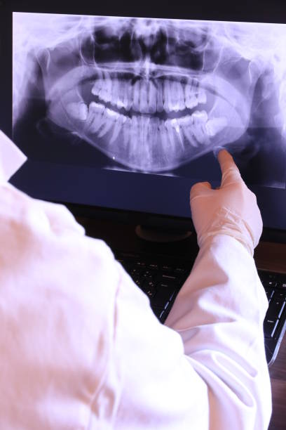 Best Emergency Treatment for Toothache in White Center, WA